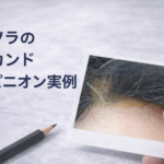 写真1枚から判断したカツラのセカンドオピニオン実例。生え際の変色と浮きが確認できる