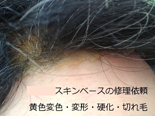 人工皮膚のひび割れ