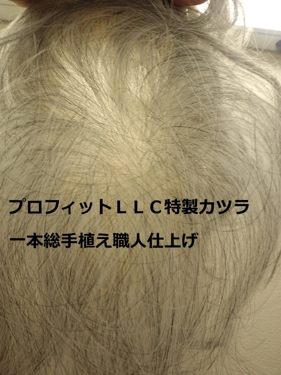 当社製かつらの毛量ステップダウン作業済。プロフィットLLC店内にて